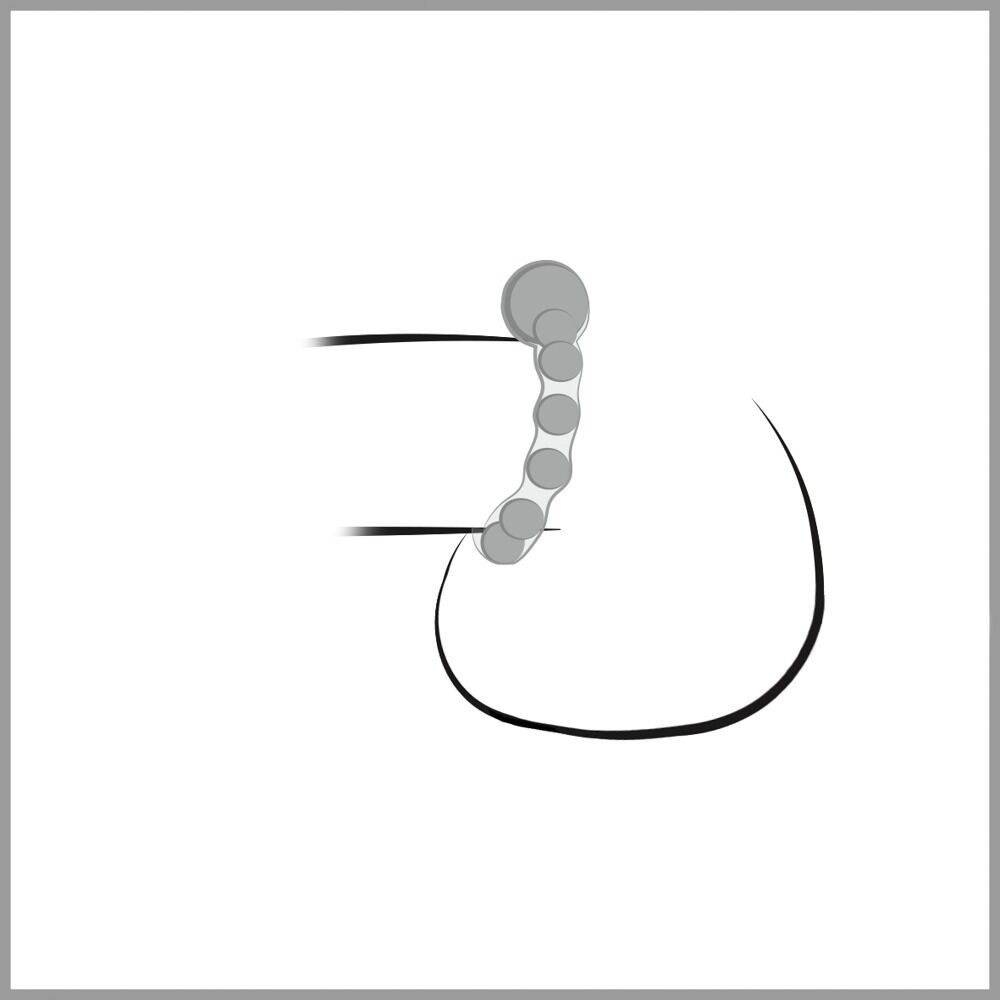 Penisring „Maximum Metal“ mit Metallkugeln